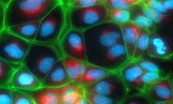 پرورش سلول‌های کاربردی کبد انسان در آزمایشگاه
