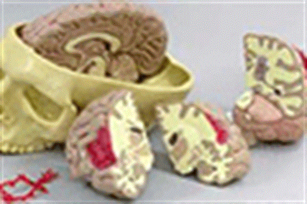 برای نخستین بار مغزی مصنوعی مشابه مغز یک جنین پنج هفته ای ساخته شد