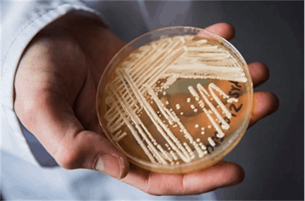 Scientists warn of deadly drug-resistant fungus spreading worldwide