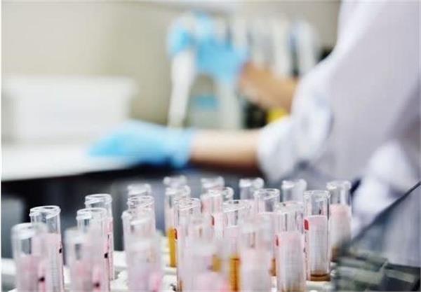 عبور موفق داروی ژن‌درمانی از سد خونی–مغزی با فناوری نانو در کرمانشاه/ گامی امیدبخش برای بیماران آلزایمر