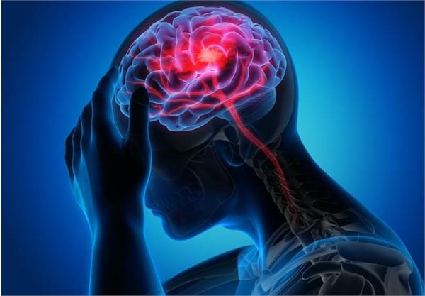 امید تازه برای کاهش عوارض سکته مغزی